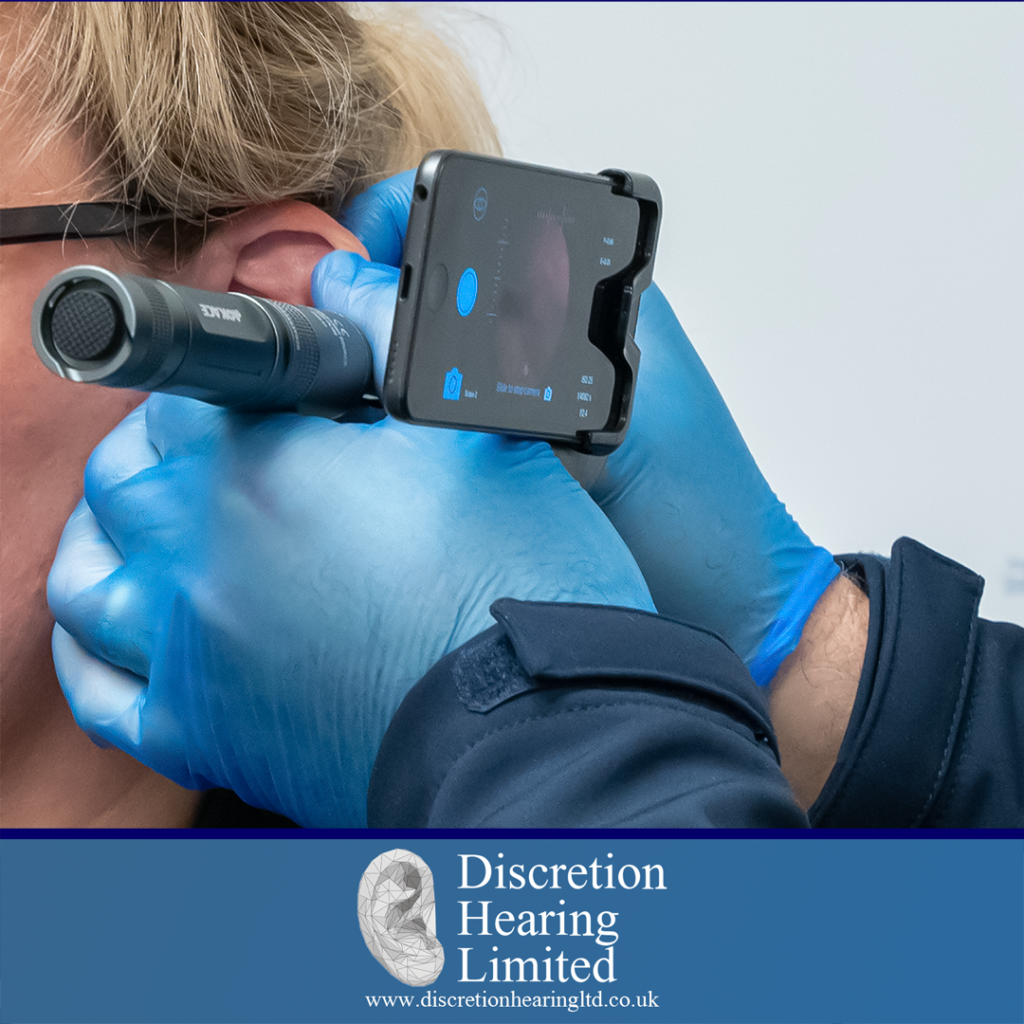 Benefits of Microsuction Ear Wax Removal - Discretion Hearing