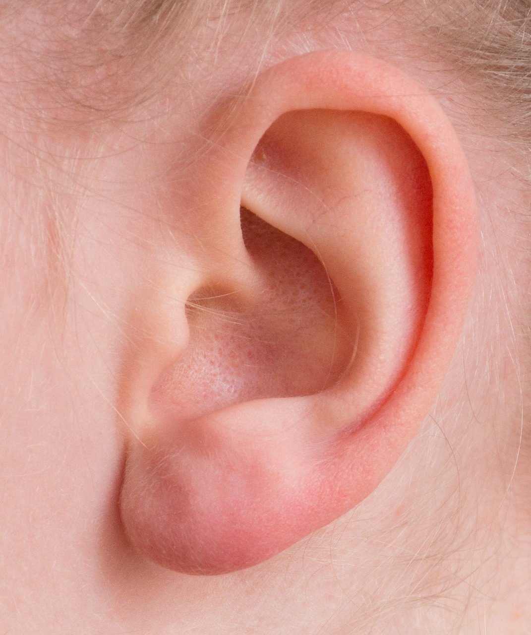 Ear Wax Removal Southport
